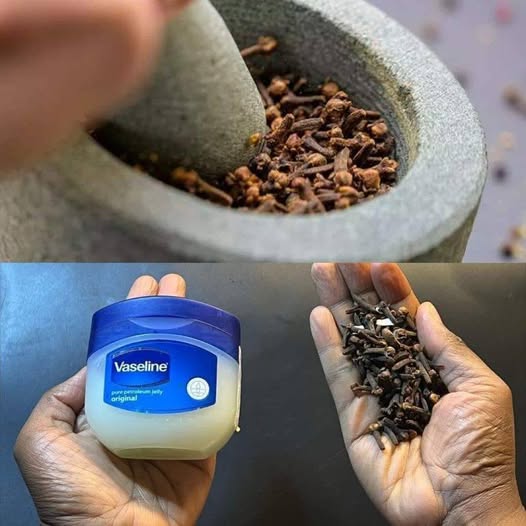 Mix Cloves with Vaseline A Secret Nobody Will Ever Tell You Thank Me Later