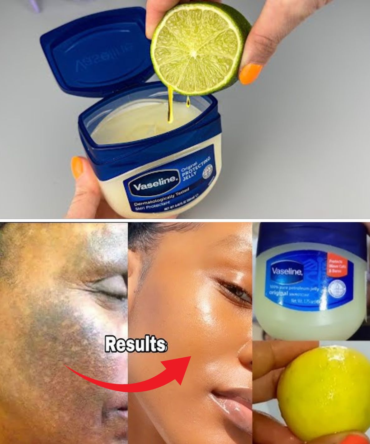 Just Mix Vaseline with Lemon and you will be shocked!