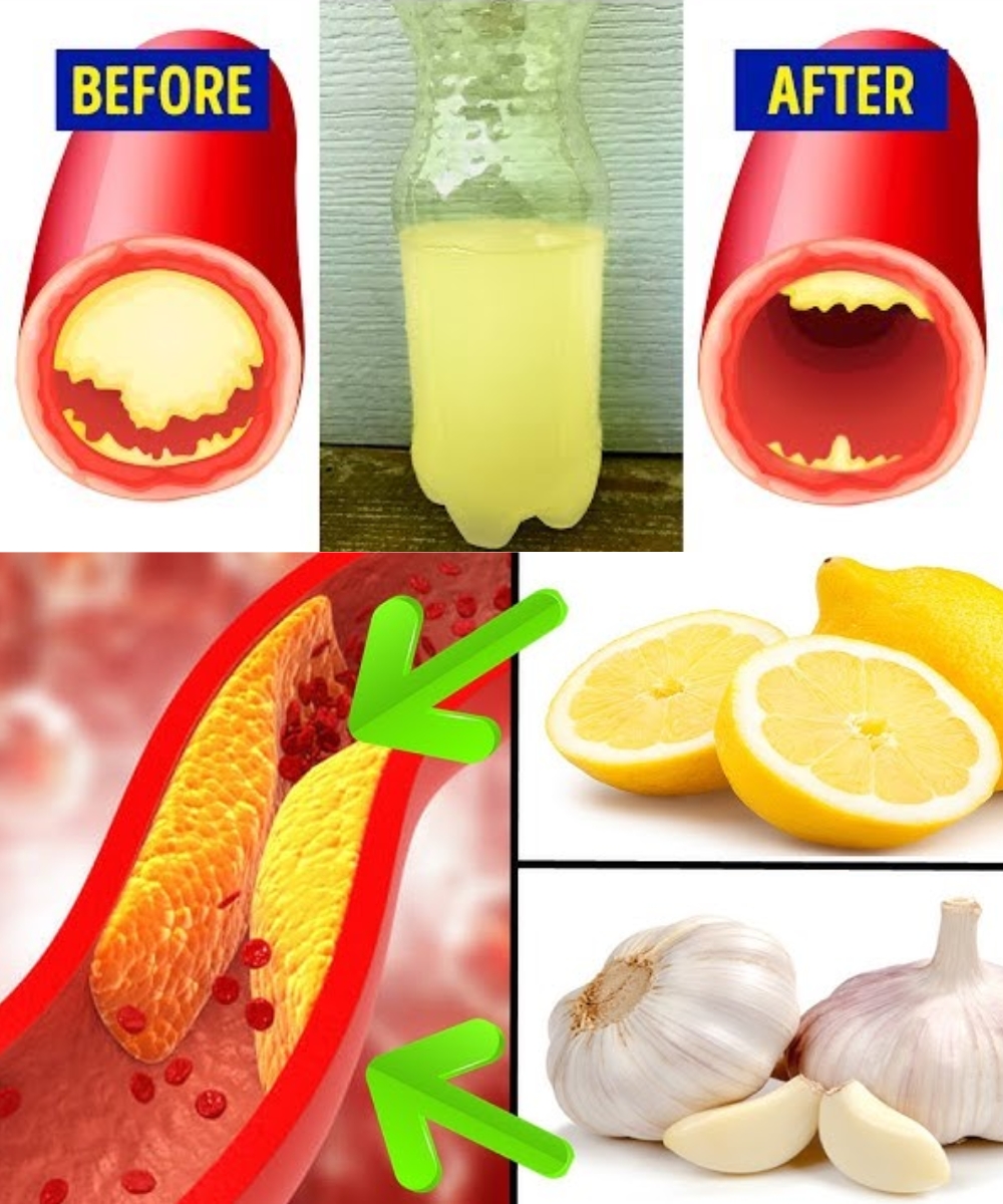 Just One Glass of This Drink Will Remove Bad Cholesterol and 10 Other Health Problems