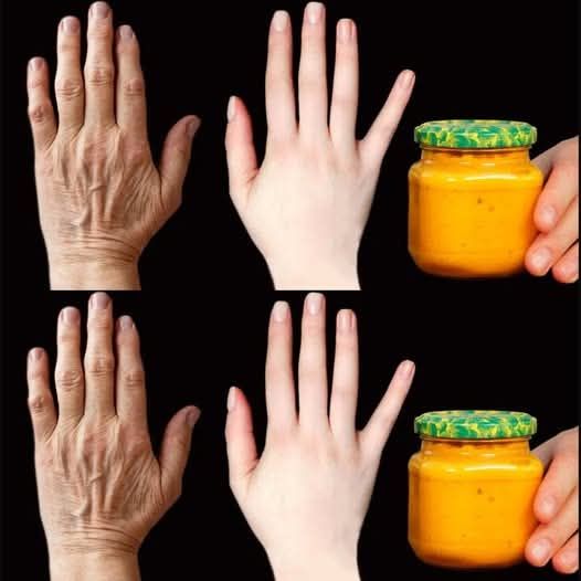 Collagen stimulation! Apply this to wrinkles even at 70, and they will disappear!