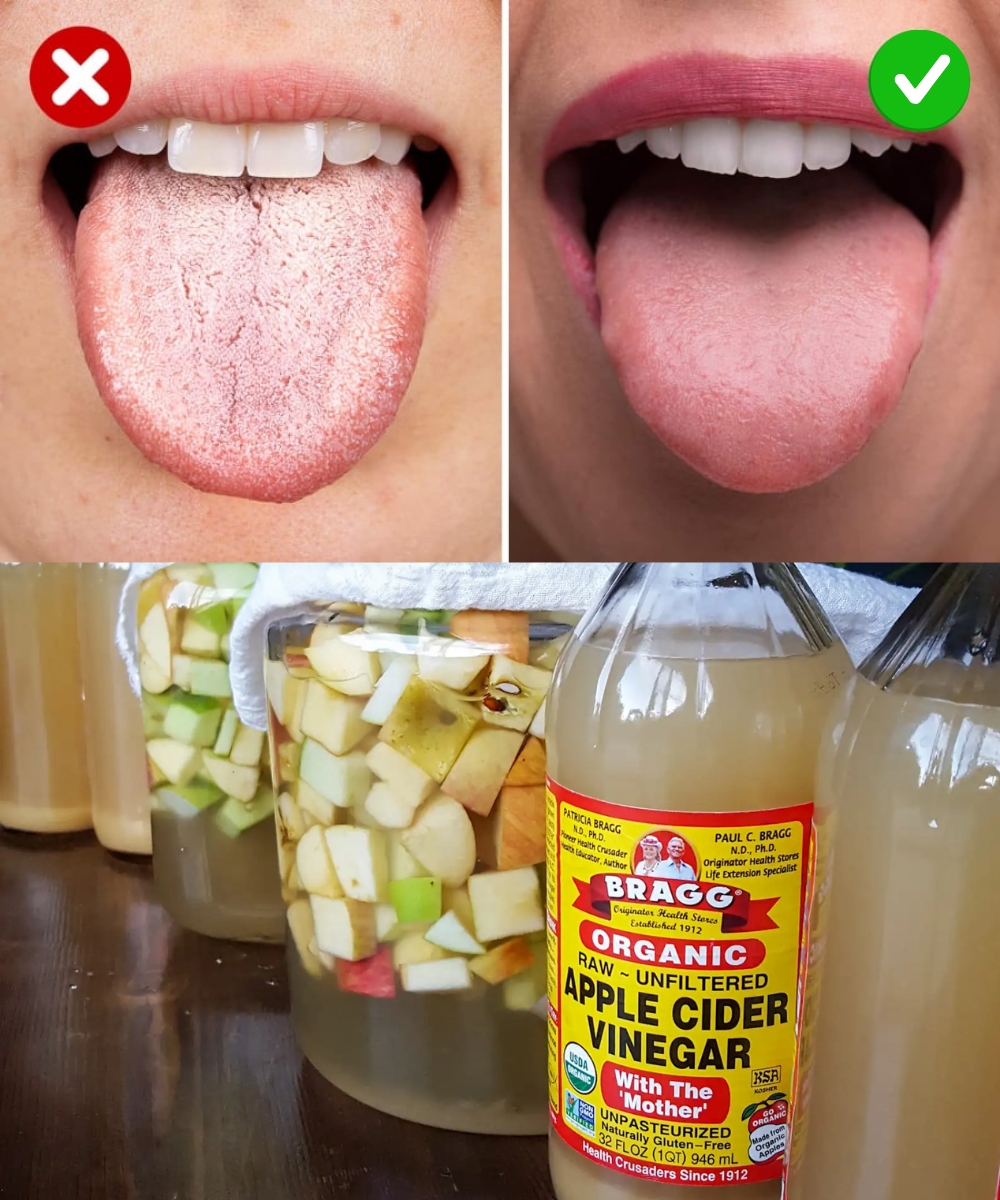 Do this before BED, the CANDIDA and FUNGI will DIE overnight
