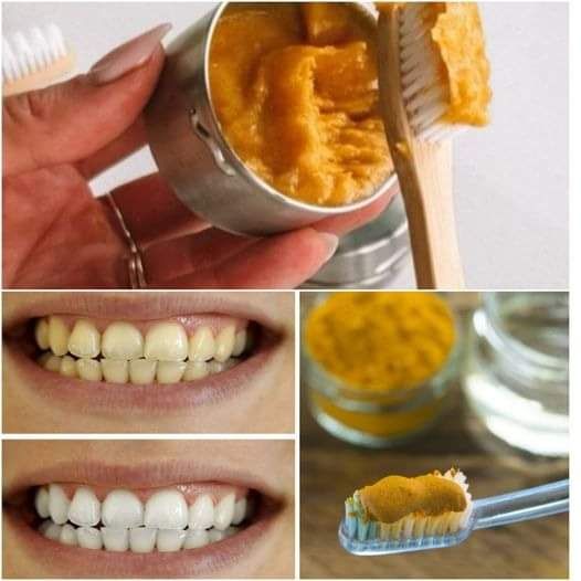 Secret that Dentists don’t want you to know: Remove Tartar and Teeth Whitening in just 2 minutes