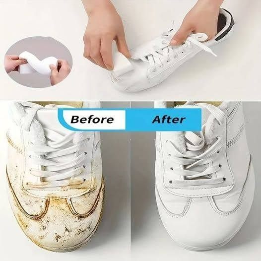 Very white shoes, nothing but bleach: this is how all the stains are removed | Now everyone does it