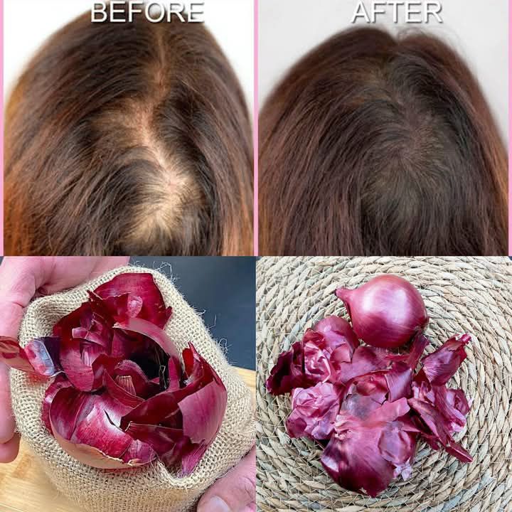 I’m shocked! After 14 days of use, the hair on my bald spot is growing like crazy!
