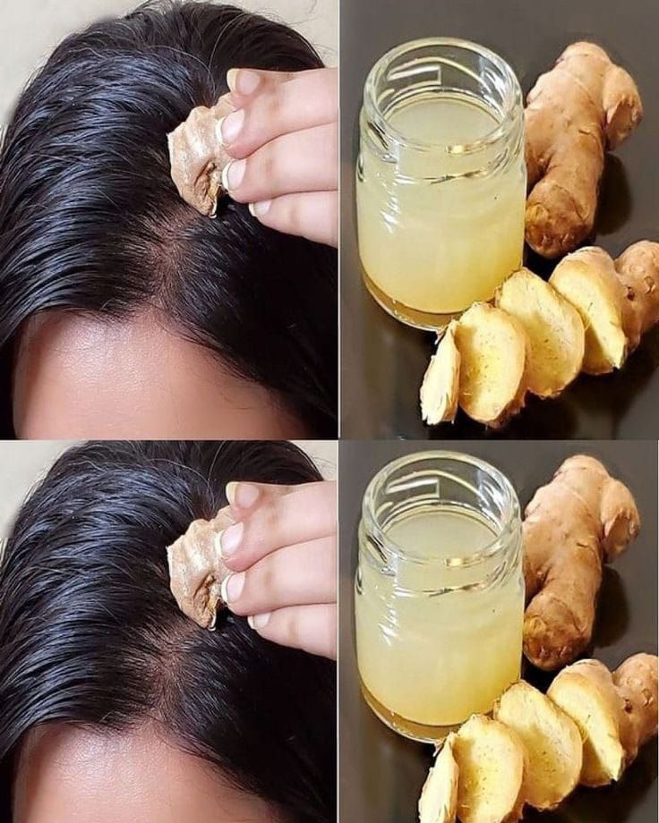 Ginger Treatment