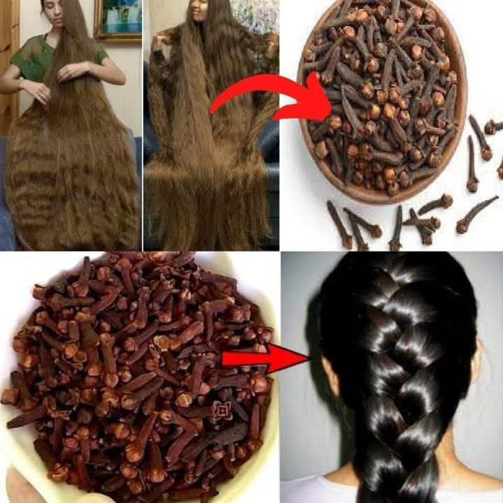 Cloves For Hair Growth: Use Cloves To Get Thicker Hair In Less Than 30 Days