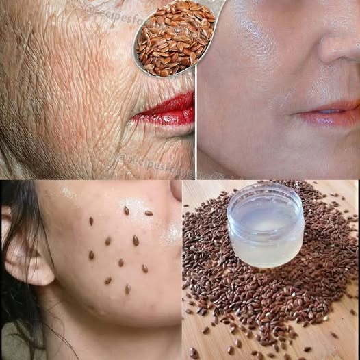 Even if you are 70, apply it to wrinkles, it will make your face taut like glass. Stronger Botox