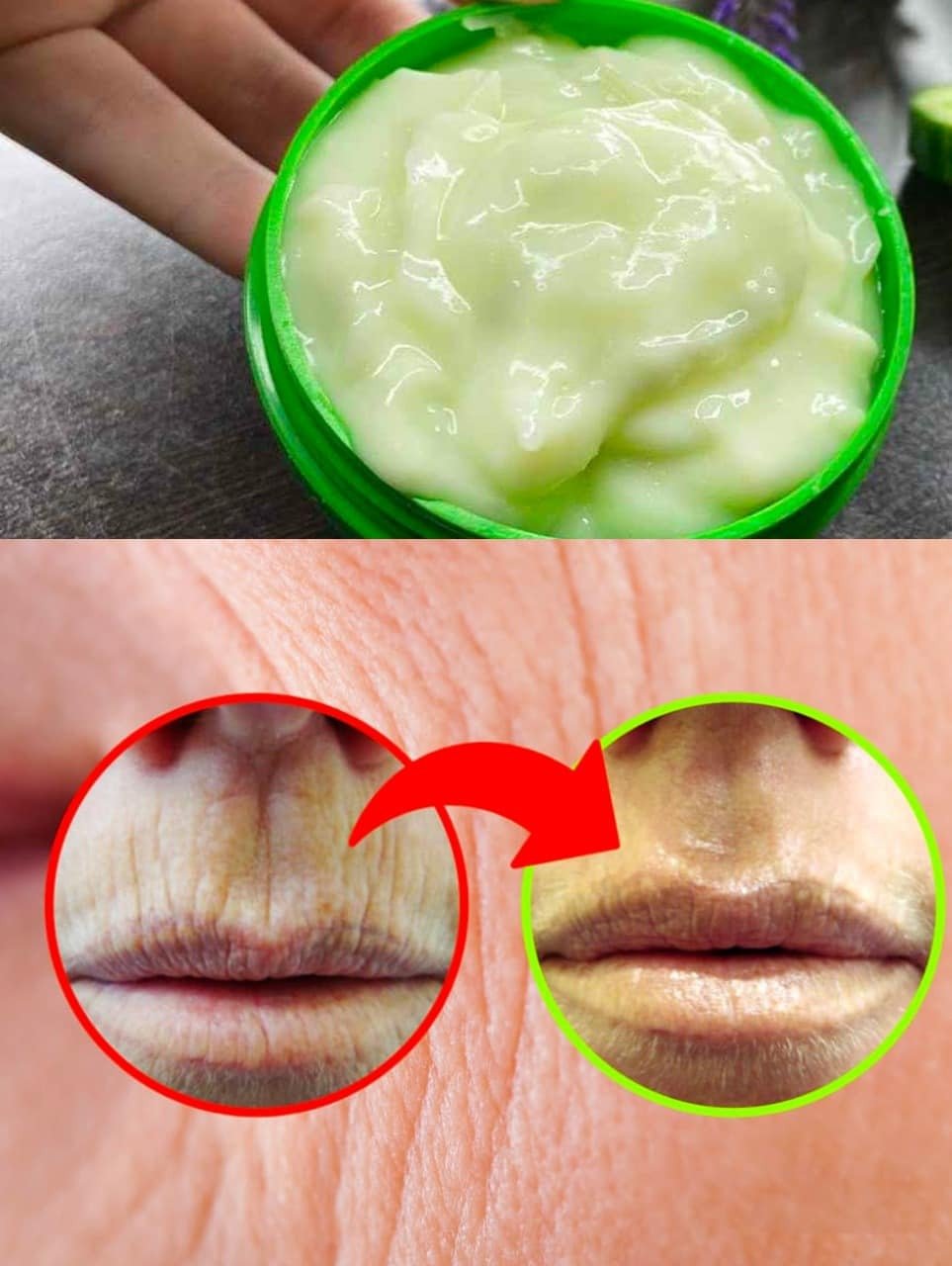 Wrinkles on the mouth, no need to waste time on creams: the