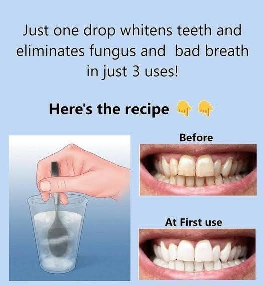 Remove tartar from your teeth and whiten them with this simple recipe