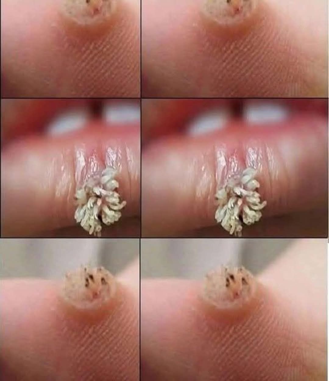 BE VERY CAREFUL . If you get this, you are infected with