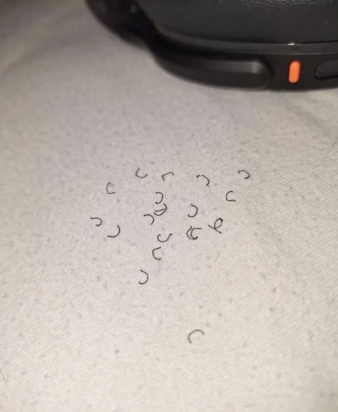 “What are these hair-like u-shaped things I found in my bed today? They were all around belly/back height.”