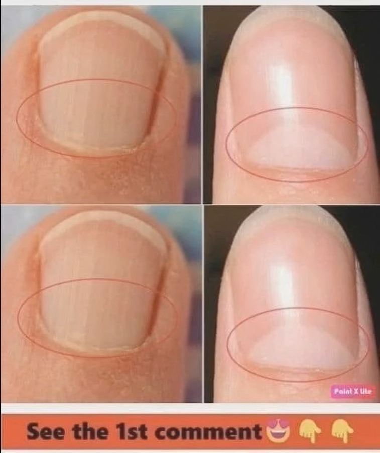If You Don’t Have a Crescent Moon Shape on Your Nails