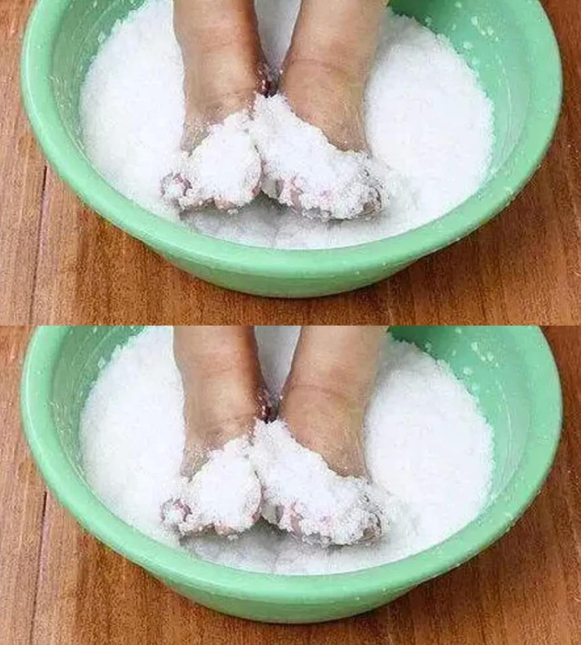 Nail Fungus, If You Find One Hurry Up and Do This Procedure Immediately