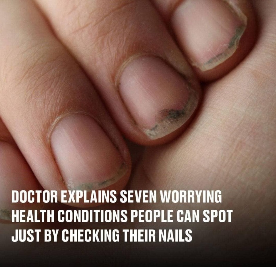 Title: 7 Surprising Health Conditions Your Nails Can Reveal