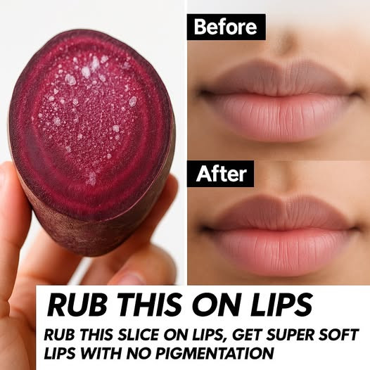 A Natural Remedy for Pigmented Lips: Beetroot Treatment for Soft, Pink Lips
